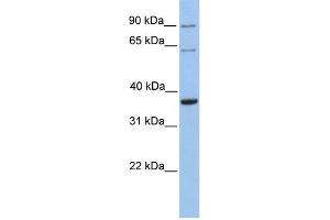 WB Suggested Anti-SLAMF6 Antibody Titration:  0.