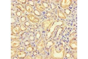Immunohistochemistry (IHC) image for anti-UDP-Gal:betaGlcNAc beta 1,4- Galactosyltransferase, Polypeptide 5 (B4GALT5) (AA 101-388) antibody (ABIN7145396)
