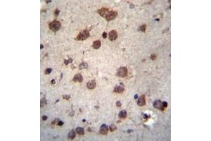 Immunohistochemistry (Paraffin-embedded Sections) (IHC (p)) image for anti-phosphorylated Adaptor For RNA Export (PHAX) (AA 304-334), (C-Term) antibody (ABIN954114)