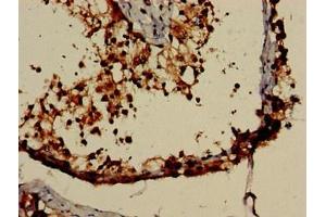 Immunohistochemistry of paraffin-embedded human testis tissue using ABIN7161885 at dilution of 1:100 (PPP1R9A Antikörper  (AA 1-243))