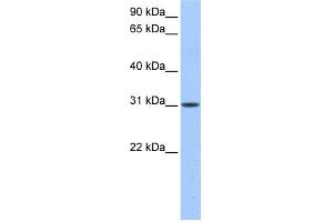 WB Suggested Anti-HUS1B Antibody Titration: 0. (HUS1B Antikörper  (N-Term))