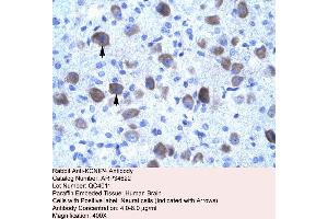Human Brain (KCNIP4 Antikörper  (N-Term))