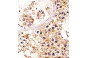 Immunohistochemical analysis of paraffin-embedded H. (EPH Receptor A4 Antikörper  (AA 383-417))