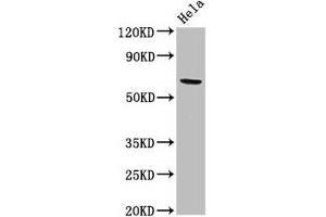 Western Blot Positive WB detected in: Hela whole cell lysate All lanes: ACADVL antibody at 2 μg/mL Secondary Goat polyclonal to rabbit IgG at 1/50000 dilution Predicted band size: 71, 69, 73 kDa Observed band size: 71 kDa (ACADVL Antikörper  (AA 403-497))