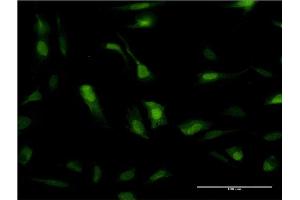 Immunofluorescence of monoclonal antibody to SOD1 on HeLa cell. (SOD1 Antikörper  (AA 1-154))