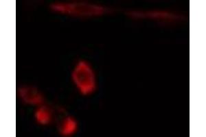 ABIN6275892 staining  Hela cells by IF/ICC. (FTH1 Antikörper  (C-Term))