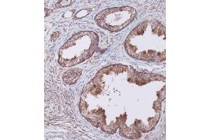 Immunohistochemical analysis of (ABIN656404 and ABIN2845698) on paraffin-embedded Human prostate tissue.