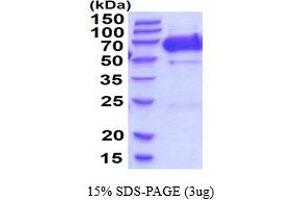 SDS-PAGE (SDS) image for Fibronectin Leucine Rich Transmembrane Protein 2 (FLRT2) (AA 36-541) protein (His tag) (ABIN6387748) (FLRT2 Protein (AA 36-541) (His tag))