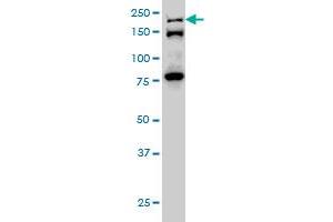 ESPL1 monoclonal antibody (M01), clone 6H6 Western Blot analysis of ESPL1 expression in Hela S3 NE . (Separase Antikörper  (AA 586-701))