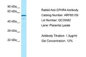 Western Blotting (WB) image for anti-Complement Factor H-Related 4 (CFHR4) (C-Term) antibody (ABIN2790060) (CFHR4 Antikörper  (C-Term))