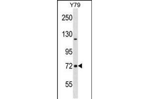 Western blot analysis in Y79 cell line lysates (35ug/lane). (NCDN Antikörper  (N-Term))