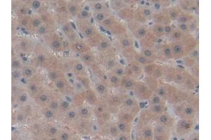 Immunohistochemistry (IHC) image for anti-Collagen, Type IV, alpha 1 (COL4A1) (AA 1444-1669) antibody (ABIN7431209)