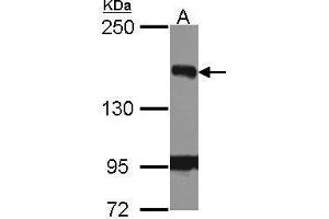 WB Image Sample (30 ug of whole cell lysate) A: Hela 5% SDS PAGE FANCJ antibody antibody diluted at 1:1000 (BRIP1 Antikörper  (N-Term))
