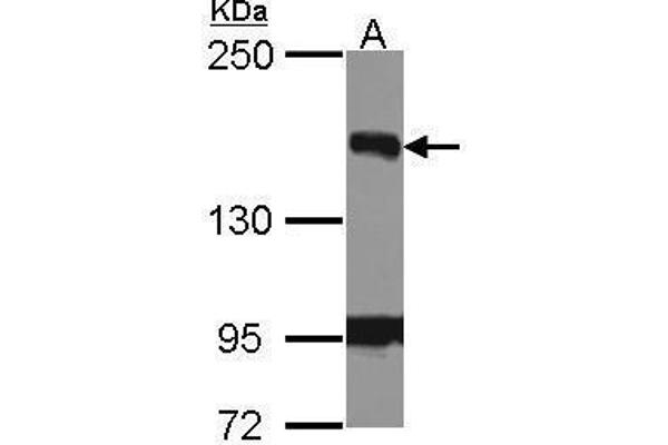 BRIP1 抗体  (N-Term)