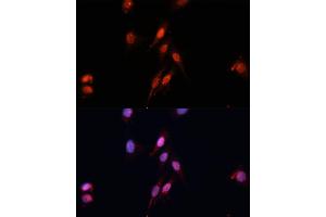 Immunofluorescence analysis of HeLa cells using Smad5 Polyclonal Antibody (ABIN6128714, ABIN6148090, ABIN6148091 and ABIN6218232) at dilution of 1:100 (40x lens). (SMAD5 Antikörper  (AA 186-465))