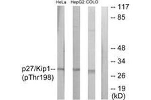 Western blot analysis of extracts from HeLa cells, HepG2 cells and COLO cells, using p27 Kip1 (Phospho-Thr198) Antibody. (CDKN1B Antikörper  (pThr198))