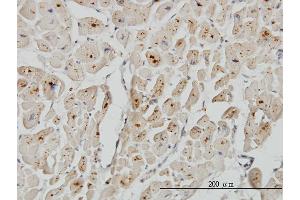 Immunoperoxidase of monoclonal antibody to ASAH1 on formalin-fixed paraffin-embedded human heart. (ASAH1 Antikörper  (AA 25-124))