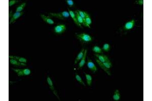 Immunofluorescence staining of Hela cells with ABIN7166389 at 1:100, counter-stained with DAPI.