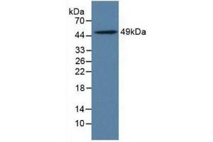 Detection of LILRB4 in Rat Adrenal Gland Tissue using Polyclonal Antibody to Leukocyte Immunoglobulin Like Receptor Subfamily B, Member 4 (LILRB4) (LILRB4 Antikörper  (AA 24-206))