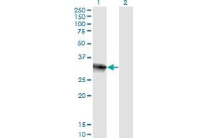 Western Blot analysis of HOXB9 expression in transfected 293T cell line by HOXB9 monoclonal antibody (M29), clone 2E8.