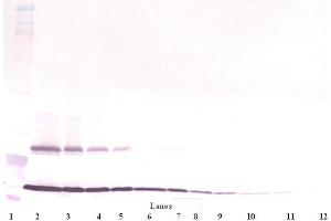 Western Blot (Unreduced) using TSLP antibody (Thymic Stromal Lymphopoietin Antikörper)