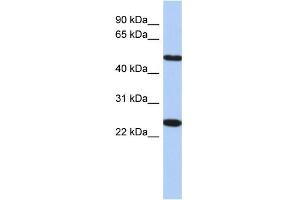anti-Transmembrane Protein 161B (TMEM161B) (N-Term) antibody