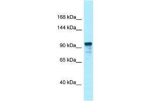 Western Blotting (WB) image for anti-Unc-13 Homolog D (UNC13D) (C-Term) antibody (ABIN2789769) (UNC13D Antikörper  (C-Term))