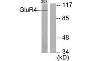 Western blot analysis of extracts from 293 cells, treated with Forskolin 40nM 30', using mGluR4 Antibody. (Metabotropic Glutamate Receptor 4 Antikörper  (AA 851-900))