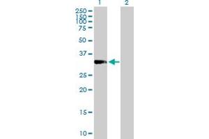 Western Blot analysis of PRKRA expression in transfected 293T cell line by PRKRA MaxPab polyclonal antibody. (PRKRA Antikörper  (AA 1-313))