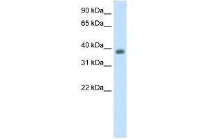 WB Suggested Anti-NEUROD2 Antibody Titration:  0. (NEUROD2 Antikörper  (C-Term))