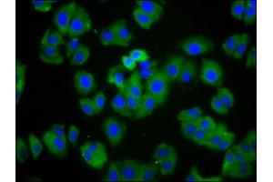 Immunofluorescence staining of HepG2 cells with ABIN7164031 at 1:166, counter-stained with DAPI. (HCN1 Antikörper  (AA 784-887))