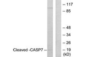 Western blot analysis of extracts from Jurkat cells, treated with Etoposide 25uM 24h, using Caspase 7 (Cleaved-Asp198) Antibody. (Caspase 7 Antikörper  (Cleaved-Asp198))