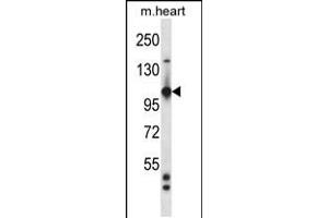 Western blot analysis in mouse heart tissue lysates (35ug/lane). (TIE1 Antikörper  (AA 361-389))
