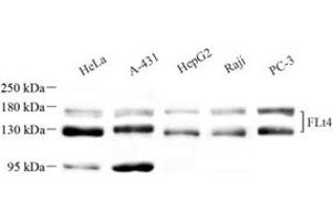 Western blot analysis of VEGF Receptor 3 (ABIN7076194) at dilution of 1: 1000 (Vegf Receptor 3 Antikörper)