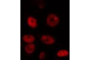 ABIN6274347 staining HepG2 cells by IF/ICC.