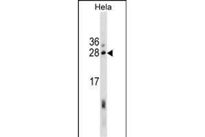 EBAG9 Antibody (Center) (ABIN1881276 and ABIN2838870) western blot analysis in Hela cell line lysates (35 μg/lane).