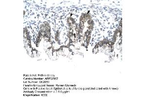 Human Stomach (Prohibitin Antikörper  (C-Term))