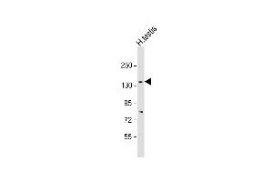 Anti-CACNA2D2 Antibody (Center) at 1:2000 dilution + human testis lysate Lysates/proteins at 20 μg per lane. (CACNA2D2 Antikörper  (AA 643-671))