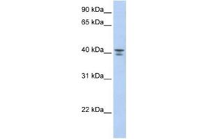 GNA12 antibody used at 1 ug/ml to detect target protein.