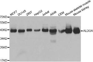 Western blot analysis of extracts of various cell lines, using ALDOA antibody. (ALDOA Antikörper)