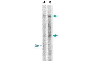 Western blot analysis of ATM in Daudi whole cell lysate with ATM polyclonal antibody  at (A) 1 and (B) 2 ug/mL .