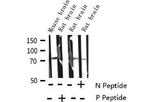 Western blot analysis of Phospho-Synapsin (Ser9) expression in various lysates (SYN1 Antikörper  (pSer9))