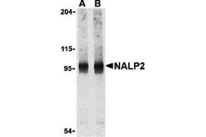Western Blotting (WB) image for anti-NLR Family, Pyrin Domain Containing 2 (NLRP2) (C-Term) antibody (ABIN1030532) (NLRP2 Antikörper  (C-Term))
