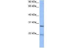 ECT2 antibody used at 1 ug/ml to detect target protein. (ECT2 Antikörper  (Middle Region))