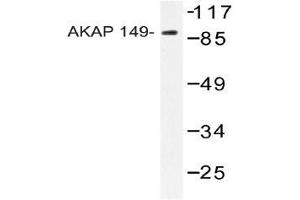 Western blot analysis of AKAP149 Antibody in extracts from HUVEC cells. (AKAP1 Antikörper)