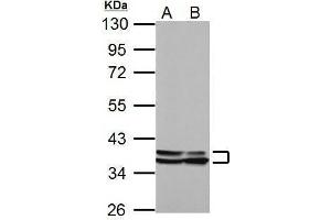Western Blotting (WB) image for anti-Annexin A1 (ANXA1) antibody (ABIN2854920)