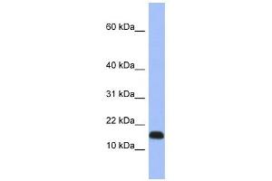 RPL37A antibody used at 1 ug/ml to detect target protein. (RPL37A Antikörper  (Middle Region))