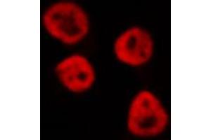 ABIN6268848 staining HeLa cells by IF/ICC. (PPARA Antikörper  (N-Term))