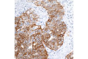 Immunohistochemistry (IHC) image for anti-Epithelial Cell Adhesion Molecule (EPCAM) (AA 264-314) antibody (ABIN7455204) (Rekombinanter EpCAM Antikörper  (AA 264-314))