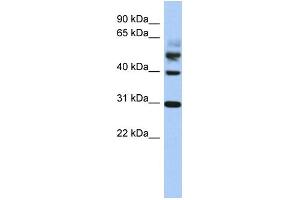 WB Suggested Anti-TTL Antibody Titration: 0. (TTL Antikörper  (Middle Region))
